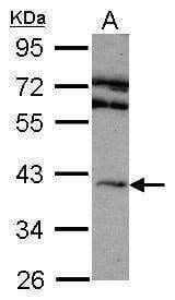 Anti-Adenosine A2A-R Antibody