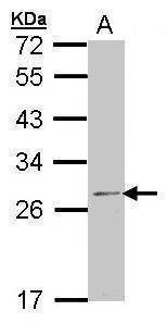 Anti-RPL14 Antibody