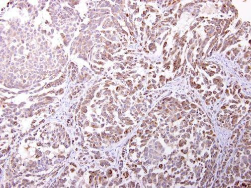 Anti-Endomucin Antibody