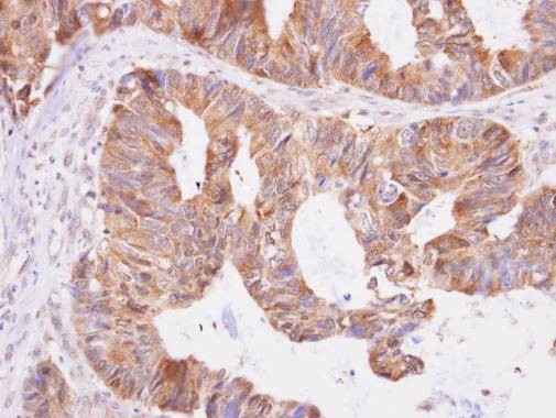 Anti-Aspartyl aminopeptidase Antibody