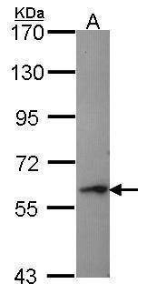Anti-Perforin 1 Antibody