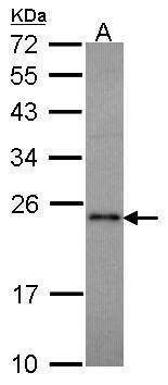 Anti-RAP1 Antibody