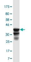 Anti-TSSK2 Antibody