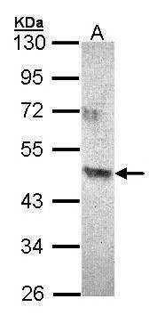 Anti-ACAD8 Antibody