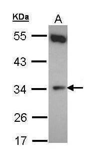 Anti-b5R.1 Antibody