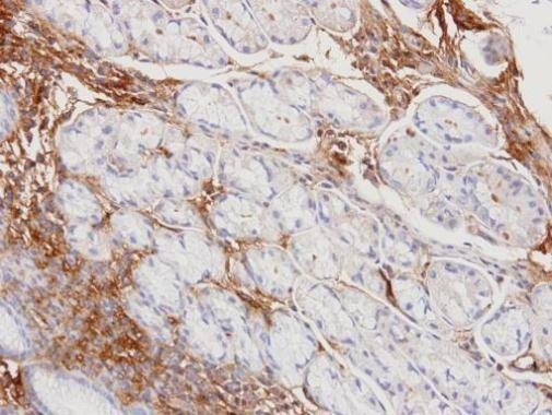 Anti-Haptoglobin Antibody