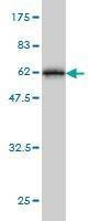 Anti-TSSK3 Antibody