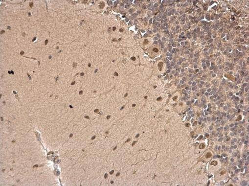Anti-CSB (internal) Antibody