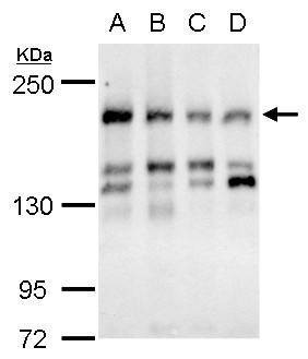 Anti-CSB (internal) Antibody