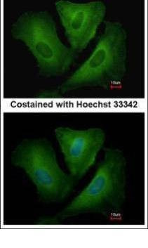 Anti-HLA-DRB3 Antibody