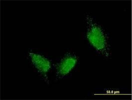 Anti-TTN Antibody