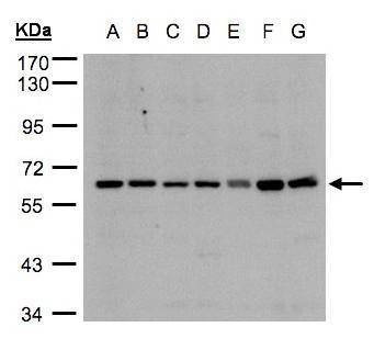 Anti-CYP24A1 Antibody