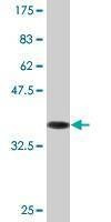 Anti-TTYH1 Antibody