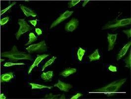 Anti-TUBA1 Antibody