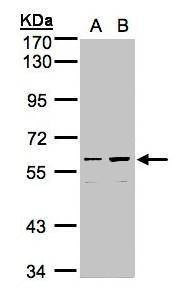 Anti-CCDC102B Antibody