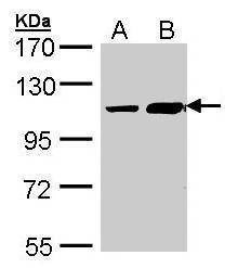 Anti-ALS2CR3 (C-term) Antibody