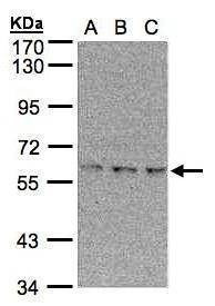 Anti-EPM2AIP1 (N-term) Antibody