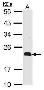 Anti-CKLFSF5 (N-term) Antibody