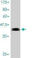Anti-AF1Q Antibody