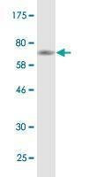 Anti-TUBB2A Antibody