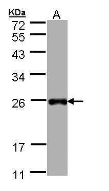 Anti-LITAF Antibody