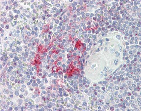 Anti-LITAF Antibody