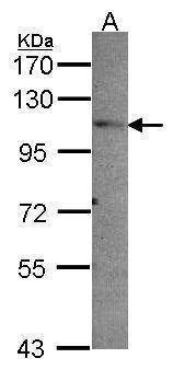 Anti-PEX6 Antibody