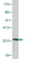 Anti-TWIST1 Antibody