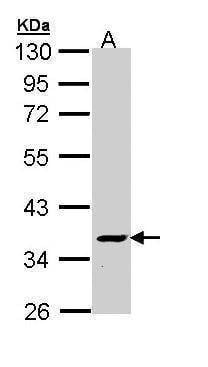 Anti-V-ATPase C2 Antibody