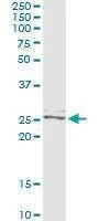 Anti-TWIST2 Antibody