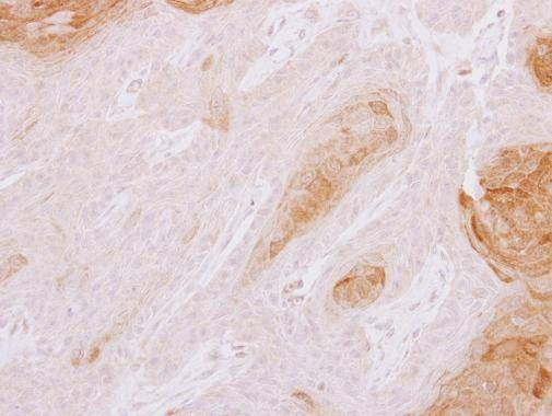 Anti-TXNDC3 Antibody