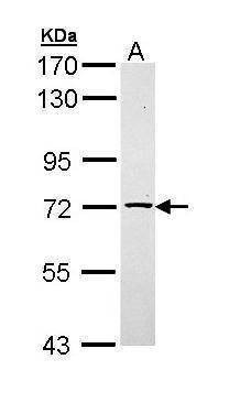 Anti-TXNDC3 Antibody