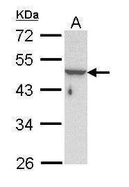 Anti-KRTHA3B Antibody