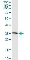 Anti-TWSG1 Antibody