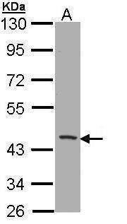Anti-CD1B Antibody