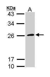 Anti-CD42c (internal) Antibody