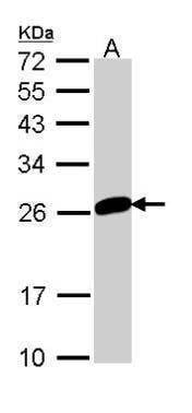 Anti-MAD2L1 Antibody