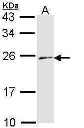 Anti-ET-3 Antibody