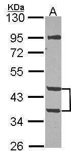 Anti-MPI Antibody