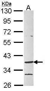Anti-GPR4 (internal) Antibody