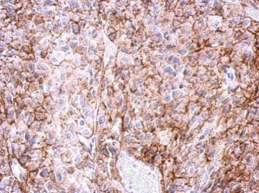 Anti-Adenosine A2a Receptor (C-term) Antibody