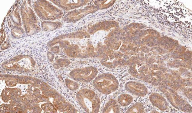 Anti-TRIM23 (N-term) Antibody