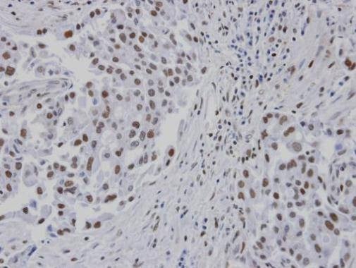 Anti-RPA14 Antibody