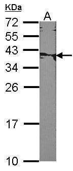 Anti-XRCC2 Antibody