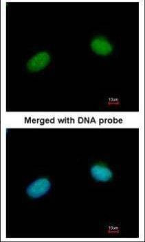 Anti-XRCC3 Antibody