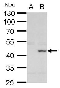 Anti-XRCC3 Antibody