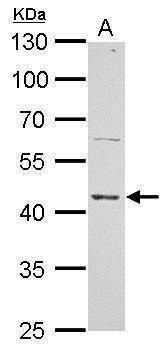 Anti-ERCC8 Antibody
