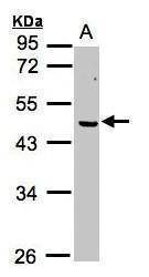 Anti-ERCC8 Antibody