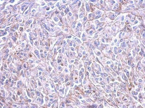 Anti-Histamine H3 Receptor Antibody