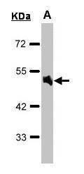 Anti-alpha 1a Adrenergic Receptor Antibody